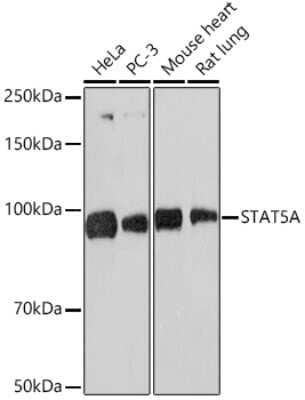 Western Blot: STAT5a/b Antibody (3J2A2) [NBP3-16533] - Western blot analysis of extracts of various cell lines, using STAT5a/b Rabbit mAb (NBP3-16533) at 1:1000 dilution. Secondary antibody: HRP Goat Anti-Rabbit IgG (H+L) at 1:10000 dilution. Lysates/proteins: 25ug per lane. Blocking buffer: 3% nonfat dry milk in TBST. Detection: ECL Basic Kit. Exposure time: 60s.