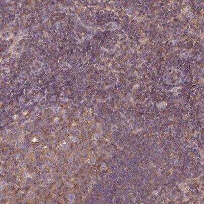 Immunohistochemistry: STAT5a/b Antibody [NBP2-46786] - Staining of human lymph node shows distinct cytoplasmic positivity in subsets of lymphoid cells.