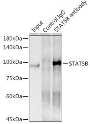 Immunoprecipitation: STAT5b Antibody (6P5T0) [NBP3-15778] - Immunoprecipitation analysis of 300ug extracts of HeLa cells using 3ug STAT5b antibody (NBP3-15778). Western blot was performed from the immunoprecipitate using STAT5b antibody (NBP3-15778) at a dilition of 1:1000.