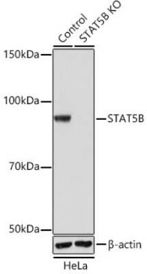 <b>Genetic Strategies Validation. </b>Knockout Validated: STAT5b Antibody (6P5T0) [NBP3-15778] - Western blot analysis of extracts from normal (control) and STAT5b knockout (KO) HeLa cells, using STAT5b antibody (NBP3-15778) at 1:1000 dilution. Secondary antibody: HRP Goat Anti-Rabbit IgG (H+L) at 1:10000 dilution. Lysates/proteins: 25ug per lane. Blocking buffer: 3% nonfat dry milk in TBST. Detection: ECL Basic Kit. Exposure time: 1s.