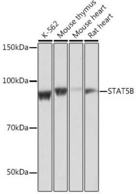 Western Blot: STAT5b Antibody (6P5T0) [NBP3-15778] - Western blot analysis of extracts of various cell lines, using STAT5b antibody (NBP3-15778) at 1:1000 dilution. Secondary antibody: HRP Goat Anti-Rabbit IgG (H+L) at 1:10000 dilution. Lysates/proteins: 25ug per lane. Blocking buffer: 3% nonfat dry milk in TBST. Detection: ECL Basic Kit. Exposure time: 1s.