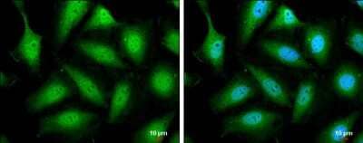 Immunocytochemistry/Immunofluorescence: STAT5b Antibody [NBP3-13069] - STAT5b antibody detects STAT5b protein at cytoplasm and nucleus by immunofluorescent analysis. Sample: HeLa cells were fixed in 4% paraformaldehyde at RT for 15 min. Green: STAT5b protein stained by STAT5b antibody (NBP3-13069) diluted at 1:500. Blue: Hoechst 33342 staining. Scale bar = 10 um.