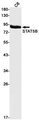 Western Blot: STAT5b Antibody (S01-6A3) [NBP3-20057] - Western blot detection of STAT5b in C6 cell lysates using NBP3-20057 (1:1000 diluted). Predicted band size: 90kDa. Observed band size: 90kDa.