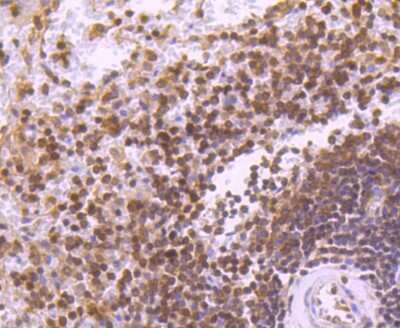 Immunohistochemistry-Paraffin: STAT5b Antibody (SD08-08) [NBP2-67795] - Analysis of paraffin-embedded human spleen tissue using anti-STAT5b antibody. Counter stained with hematoxylin.