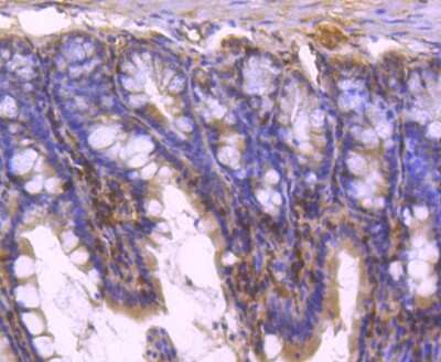 Immunohistochemistry-Paraffin: STAT5b Antibody (SD08-08) [NBP2-67795] - Analysis of paraffin-embedded mouse colon tissue using anti-STAT5b antibody. Counter stained with hematoxylin.