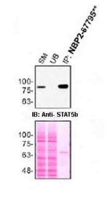 Immunoprecipitation: STAT5b Antibody (SD08-08) [NBP2-67795] - HAP1 lysates were prepared, and immunoprecipitation was performed using 2.0 ug of STAT5b antibody (NBP2-67795) pre-coupled to Dynabeads protein A. Samples were washed and processed for immunoblot with NBP2-67795. For immunoblot, anti-STAT5b was used at 1/1000. The Ponceau stained transfer of the blot is shown. SM=10% starting material; UB=10% unbound fraction; IP=immunoprecipitate. Image, protocol and testing courtesy of YCharOS Inc. (ycharos.com).