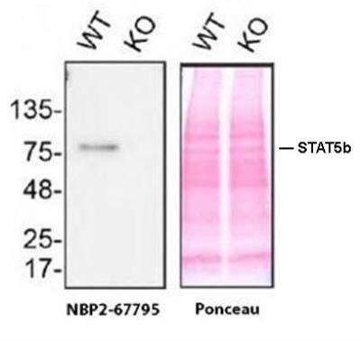 Knockout Validated: STAT5b Antibody (SD08-08) [NBP2-67795] - Lysates of HAP1 WT and STAT5b KO were prepared, and 20 ug of protein were processed for immunoblot with STAT5b antibody. The Ponceau stained transfer of the blot is shown. Antibody dilution used: NBP2-67795 at 1/1000. Predicted band size: 90 kDa. Image, protocol and testing courtesy of YCharOS Inc. (ycharos.com).