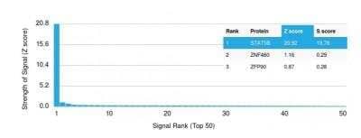 Protein Array: STAT5b Antibody (STAT5B/2611) [NBP2-79773] - Analysis of Protein Array containing >19,000 full-length human proteins using  Z- and S- Score: The Z-score represents the strength of a signal that a monoclonal antibody (Monoclonal Antibody) (in combination with a fluorescently-tagged anti-IgG secondary antibody) produces when binding to a particular protein on the HuProt(TM) array. Z-scores are described in units of standard deviations (SD's) above the mean value of all signals generated on that array. If targets on HuProt(TM) are arranged in descending order of the Z-score, the S-score is the difference (also in units of SD's) between the Z-score. S-score therefore represents the relative target specificity of a Monoclonal Antibody to its intended target. A Monoclonal Antibody is considered to specific to its intended target, if the Monoclonal Antibody has an S-score of at least 2.5