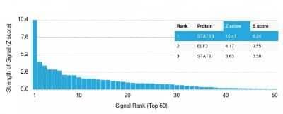 Protein Array: STAT5b Antibody (STAT5B/2657) [NBP3-07323] - Analysis of Protein Array containing >19,000 full-length human proteins using STAT5b Mouse Monoclonal Antibody (STAT5b/2657).