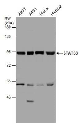 Western Blot: STAT5b Antibody [NBP3-13069] - Various whole cell extracts (30 ug) were separated by 7.5% SDS-PAGE, and the membrane was blotted with STAT5b antibody (NBP3-13069) diluted at1:1000.