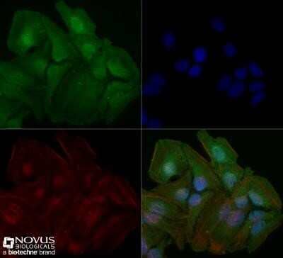 Immunocytochemistry/Immunofluorescence: STAT6 Antibody (177C322.1) - Azide and BSA Free [NBP2-80965] - HeLa cells were fixed for 10 minutes using 10% formalin and then permeabilized for 5 minutes using 1X TBS + 0.5% Triton-X100. The cells were incubated with anti-STAT6 (177C322.1) at 5 ug/ml overnight at 4C and detected with an anti-mouse Dylight 488 (Green) at a 1:500 dilution. Actin was detected with Phalloidin 568 (Red) at a 1:200 dilution. Nuclei were counterstained with DAPI (Blue). Cells were imaged using a 40X objective. Image from the standard format of this antibody.