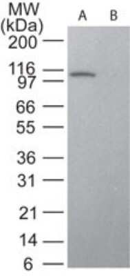 Western Blot: STAT6 Antibody (177C322.1) - Azide and BSA Free [NBP2-80965] - Analysis of STAT6 in HeLa lysate in the A) absence and B) presence of immunizing peptide using STAT6 antibody at 2 ug/ml. anti mouse Ig HRP secondary antibody and ECL substrate were used for this test. Image from the standard format of this antibody.