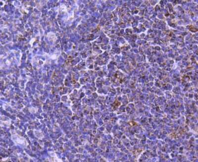 Immunohistochemistry-Paraffin: STAT6 Antibody (SY02-72) [NBP2-67445] - Analysis of paraffin-embedded human tonsil tissue using anti-STAT6 antibody. Counter stained with hematoxylin.