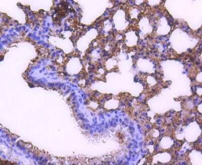 Immunohistochemistry-Paraffin: STAT6 Antibody (SY02-72) [NBP2-67445] - Analysis of paraffin-embedded mouse lung tissue using anti-STAT6 antibody. Counter stained with hematoxylin.