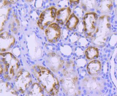 Immunohistochemistry-Paraffin: STAT6 Antibody (SY13-09) [NBP2-67393] - Analysis of paraffin-embedded human kidney tissue using anti-STAT6 antibody. Counter stained with hematoxylin.