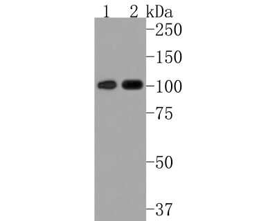 Western Blot: STAT6 Antibody (SY13-09) [NBP2-67393] - Analysis of STAT6 on different lysates. Proteins were transferred to a PVDF membrane and blocked with 5% BSA in PBS for 1 hour at room temperature. The primary antibody (1/500) was used in 5% BSA at room temperature for 2 hours. Goat Anti-Rabbit IgG - HRP Secondary Antibody at 1:200,000 dilution was used for 1 hour at room temperature. Positive control: Lane 1: Raji cell lysate Lane 2: Daudi cell lysate Predicted band size: 94 kDa Observed band size: 100 kDa