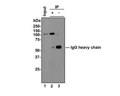 Western Blot: STAT6 Antibody (SY13-09) [NBP2-67393] - STAT6 was immunoprecipitated from 0.5 mg Hela whole cell lysates with NBP2-67393 at 2 ug/mL. Western blot was performed from the immunoprecipitate using NBP2-67393 at 1/500 dilution for 45 minutes at room temperature. Goat anti-Rabbit IgG-HRP Secondary Antibody was used at 1:300,000 dilution for 30 minutes at room temperature. Lane 1: Hela whole cell lysates at 10 ug; Lane 2: STAT6 IP in Hela whole cell lysates; Lane 3: Rabbit IgG instead of STAT6 in Hela whole cell lysates. Predicted band size: 94 kDa Observed band size: 100 kDa Exposure time: 2 minutes; 8% SDS-PAGE gel.
