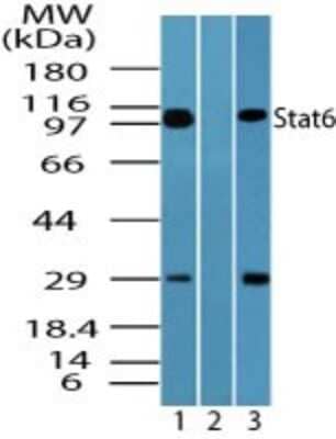 Western Blot: STAT6 Antibody [NBP2-24826] - Analysis in human Jurkat lysate in the 1) absence and 2) presence of immunizing peptide, and 3) mouse RAW lysate at 0.25 ug/ml. Note: bands were detected at a slightly higher molecular weight than the predicted MW of 94 kDa.