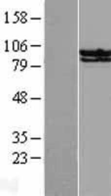 Western Blot STAT6 Overexpression Lysate