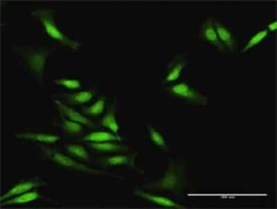 Immunocytochemistry/Immunofluorescence: STAU2 Antibody [H00027067-D01P] - Analysis of antibody to STAU2 on HeLa cell. Antibody concentration 30 ug/ml.
