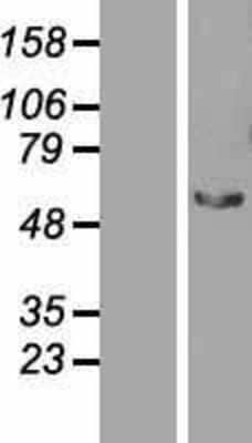 Western Blot: STAU2 Overexpression Lysate (Adult Normal) [NBP2-07346] Left-Empty vector transfected control cell lysate (HEK293 cell lysate); Right -Over-expression Lysate for STAU2.