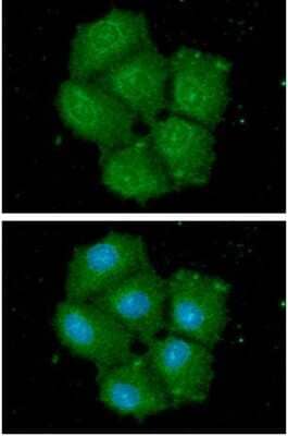 Immunocytochemistry/Immunofluorescence: STCH Antibody (2F6) [NBP2-60243] - Staining in Hep3B cells. The secondary antibody (green) was Alexa Fluor 488. DAPI was stained the cell nucleus (blue).