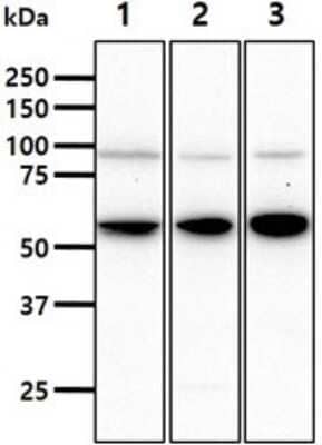 Western Blot: STCH Antibody (2F6) [NBP2-60243] - The cell lysates (40ug) were resolved by SDS-PAGE, transferred to PVDF membrane , (1:1000). Proteins were visualized using a goat anti-mouse secondary antibody conjugated to HRP and an ECL detection system.Lane 1.: 293T cell lysateLane 2.: K562 cell lysate Lane 3.: MCF7 cell lysate