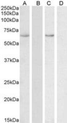 Western Blot: STCH Antibody [NBP2-26194] - Staining of Human Uterus lysate (A) + peptide (B) with antibody at 0.1 ug/mL and  Colon lysate (C) + peptide (D) with antibody at 0.3 ug/mL (35 ug protein in RIPA buffer). Detected by chemiluminescence.