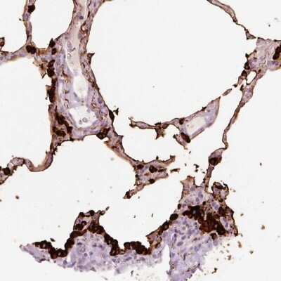 Immunohistochemistry-Paraffin: STEAP1 Antibody [NBP2-48603] - Staining of human lung shows strong cytoplasmic and membranous positivity in pneumocytes.