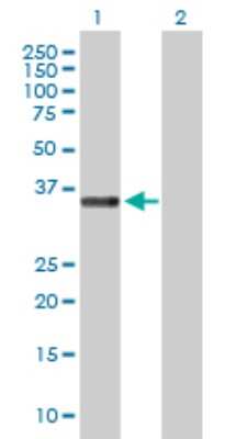 Western Blot: STEAP1 Antibody [H00026872-D01P] - Analysis of STEAP1 expression in transfected 293T cell line by STEAP1 polyclonal antibody.Lane 1: STEAP1 transfected lysate(39.90 KDa).Lane 2: Non-transfected lysate.