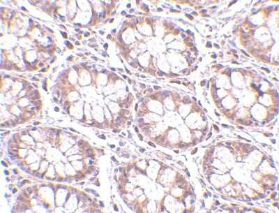 Immunohistochemistry-Paraffin: STEAP2 Antibody [NBP1-76823] - Human colon tissue with STEAP2 antibody at 2.5 ug/ml.