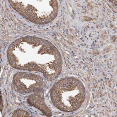 Immunohistochemistry-Paraffin: STEAP2 Antibody [NBP1-83100] - Staining of human prostate shows moderate cytoplasmic positivity in glandular cells.