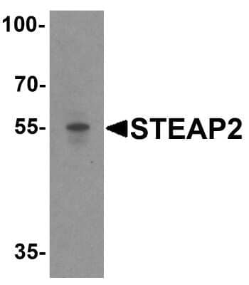 Western Blot: STEAP2 Antibody [NBP1-76823] - Analysis in human prostate tissue lysate with antibody at 1 ug/mL.