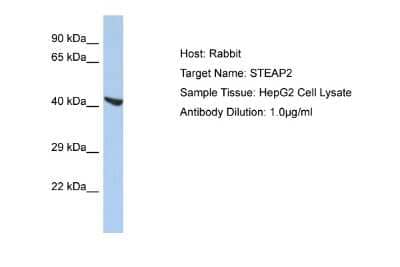 Western Blot: STEAP2 Antibody [NBP2-88370] - Host: Rabbit. Target Name: STEAP2. Sample Type: HepG2 Whole Cell lysates. Antibody Dilution: 1.0ug/ml