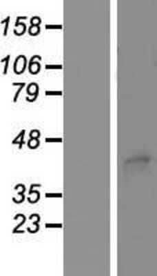 Western Blot: STEAP3 Overexpression Lysate (Adult Normal) [NBP2-06848] Left-Empty vector transfected control cell lysate (HEK293 cell lysate); Right -Over-expression Lysate for STEAP3.