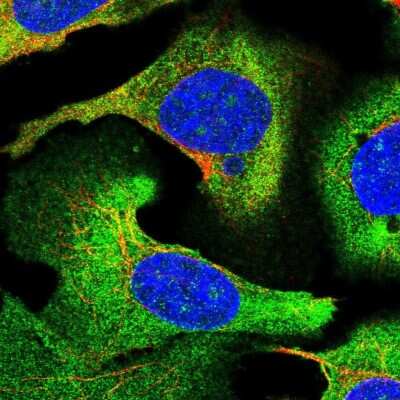 Immunocytochemistry/Immunofluorescence: STEAP3/TSAP6 Antibody [NBP2-13395] - Staining of human cell line U-2 OS shows localization to nucleoli & cytosol. Antibody staining is shown in green.