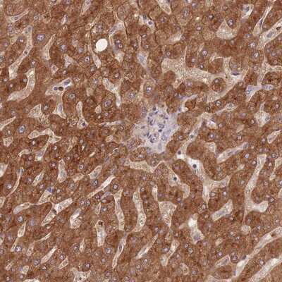 Immunohistochemistry-Paraffin: STEAP3/TSAP6 Antibody [NBP2-13395] - Staining of human liver shows strong cytoplasmic and membranous positivity in hepatocytes.