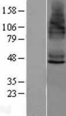 Western Blot: STEAP4 Overexpression Lysate (Adult Normal) [NBL1-16537] Left-Empty vector transfected control cell lysate (HEK293 cell lysate); Right -Over-expression Lysate for STEAP4.