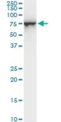 Western Blot: STI1 Antibody (1C6) [H00010963-M06] - Analysis of STIP1 expression in PC-12.