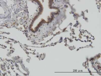 Immunohistochemistry-Paraffin: STI1 Antibody (1E3) [H00010963-M11] - Analysis of monoclonal antibody to STIP1 on formalin-fixed paraffin-embedded human lung. Antibody concentration 3 ug/ml