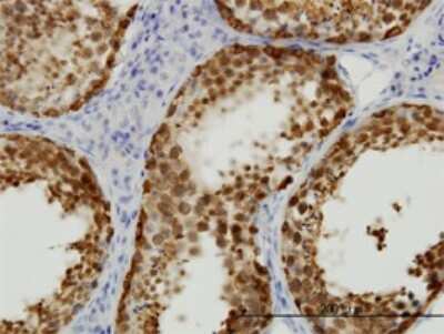 Immunohistochemistry-Paraffin: STI1 Antibody (4B6) [H00010963-M01] - Analysis of monoclonal antibody to STIP1 on formalin-fixed paraffin-embedded human testis. Antibody concentration 0.3 ug/ml.