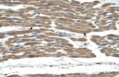 Immunohistochemistry-Paraffin: STI1 Antibody [NBP1-57837] - Human Muscle Tissue, Skeletal muscle cells (Indicated with Arrows) 4-8ug/ml.