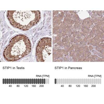 Immunohistochemistry-Paraffin: STI1 Antibody [NBP2-32621] - Staining in human testis and pancreas tissues using anti-STIP1 antibody. Corresponding STIP1 RNA-seq data are presented for the same tissues.