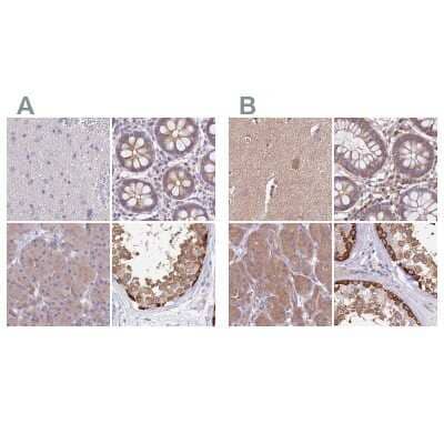 <b>Independent Antibodies Validation. </b>Immunohistochemistry-Paraffin: STI1 Antibody [NBP2-33411] - Staining of human cerebral cortex, colon, pancreas and testis using Anti-STIP1 antibody NBP2-33411 (A) shows similar protein distribution across tissues to independent antibody NBP2-32621 (B).