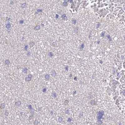 <b>Independent Antibodies Validation. </b>Immunohistochemistry-Paraffin: STI1 Antibody [NBP2-33411] - Staining of human cerebral cortex.