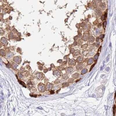 Immunohistochemistry-Paraffin: STI1 Antibody [NBP2-33411] - Staining of human testis.