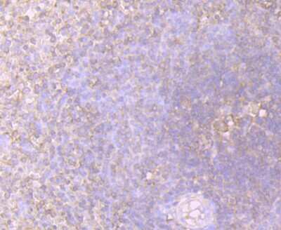 Immunohistochemistry-Paraffin: STI1 Antibody (JB95-38) [NBP2-75675] - Analysis of paraffin-embedded human spleen tissue using anti-STIP1 antibody. Counter stained with hematoxylin.