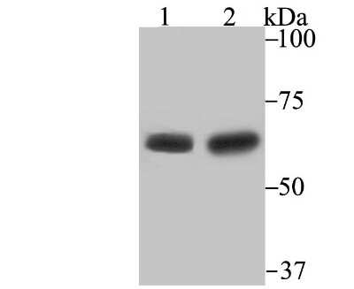 Western Blot: STI1 Antibody (JB95-38) [NBP2-75675] - Analysis of STIP1 on Mouse testis and Rat testis lysates using anti-STIP1 antibody at 1/500 dilution.