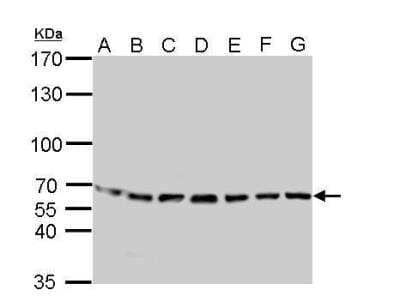 Western Blot: STI1 Antibody [NBP1-32145] - A. 30 ug Neuro2A whole cell lysate/extract  B. 30 ug GL261 whole cell lysate/extract  C. 30 ug C8D30 whole cell lysate/extract  D. 30 ug NIH-3T3 whole cell lysate/extract  E. 30 ug BCL-1 whole cell lysate/extract  F. 30 ug Raw264.7 whole cell lysate/extract  G. 30 ug C2C12 whole cell lysate/extract 7.5 % SDS-PAGE STIP1 antibody dilution: 1:1000