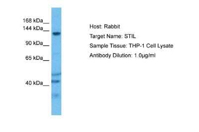 Western Blot: STIL Antibody [NBP2-83601] - WB Suggested Anti-STIL antibody Titration: 1 ug/mL. Sample Type: Human THP-1 Whole Cell